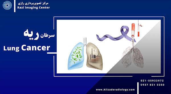 سرطان ریه و دقیق ترین راه تشخیص آن